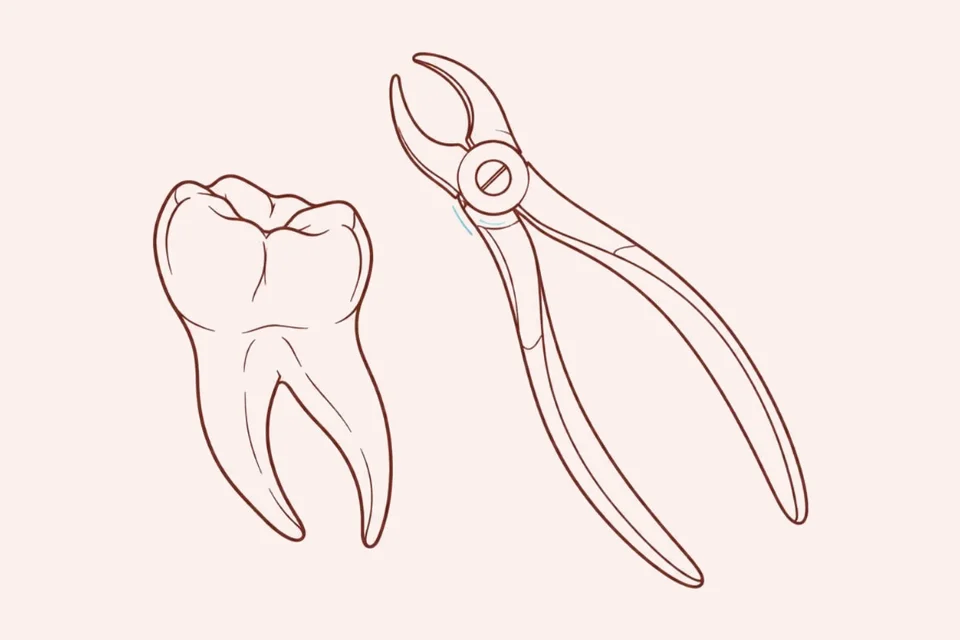 Ilustração de cirurgias orais