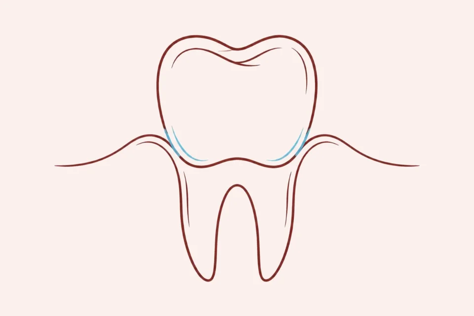 Ilustração de periodontia